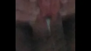 subincision, penis